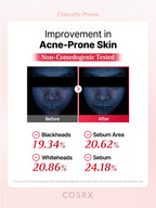 One Step Original Blemish Pore Clear Pad