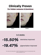 24-HR Synergy Duo (Acne Free)